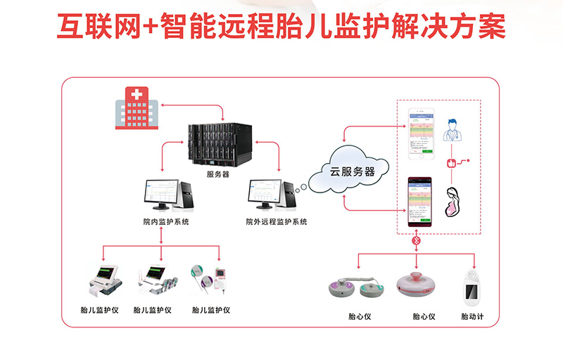 互联网+远程胎儿监护系统